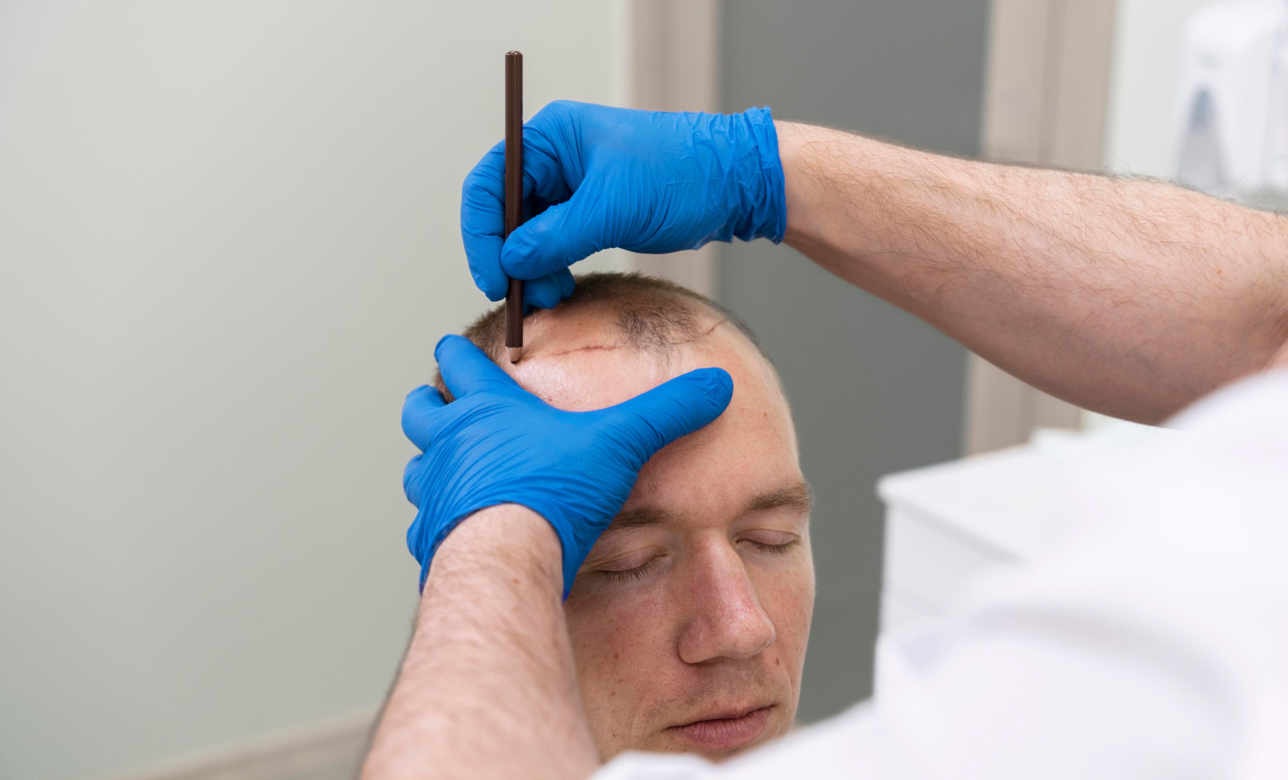 Hair Restoration
